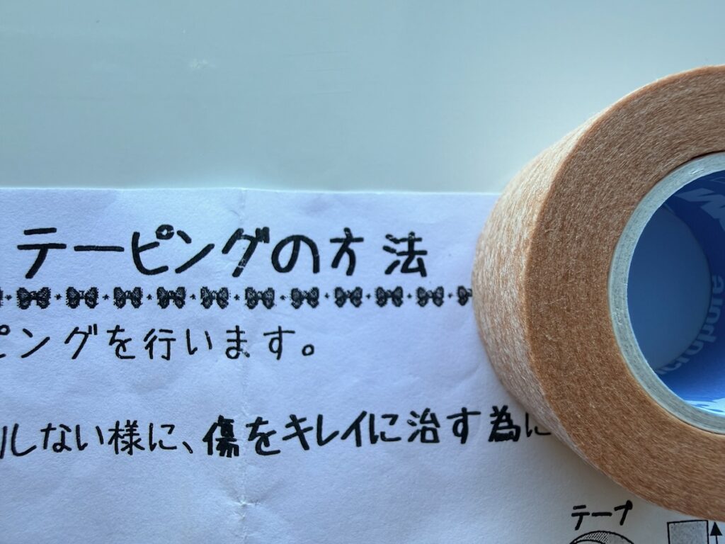 テープと方法